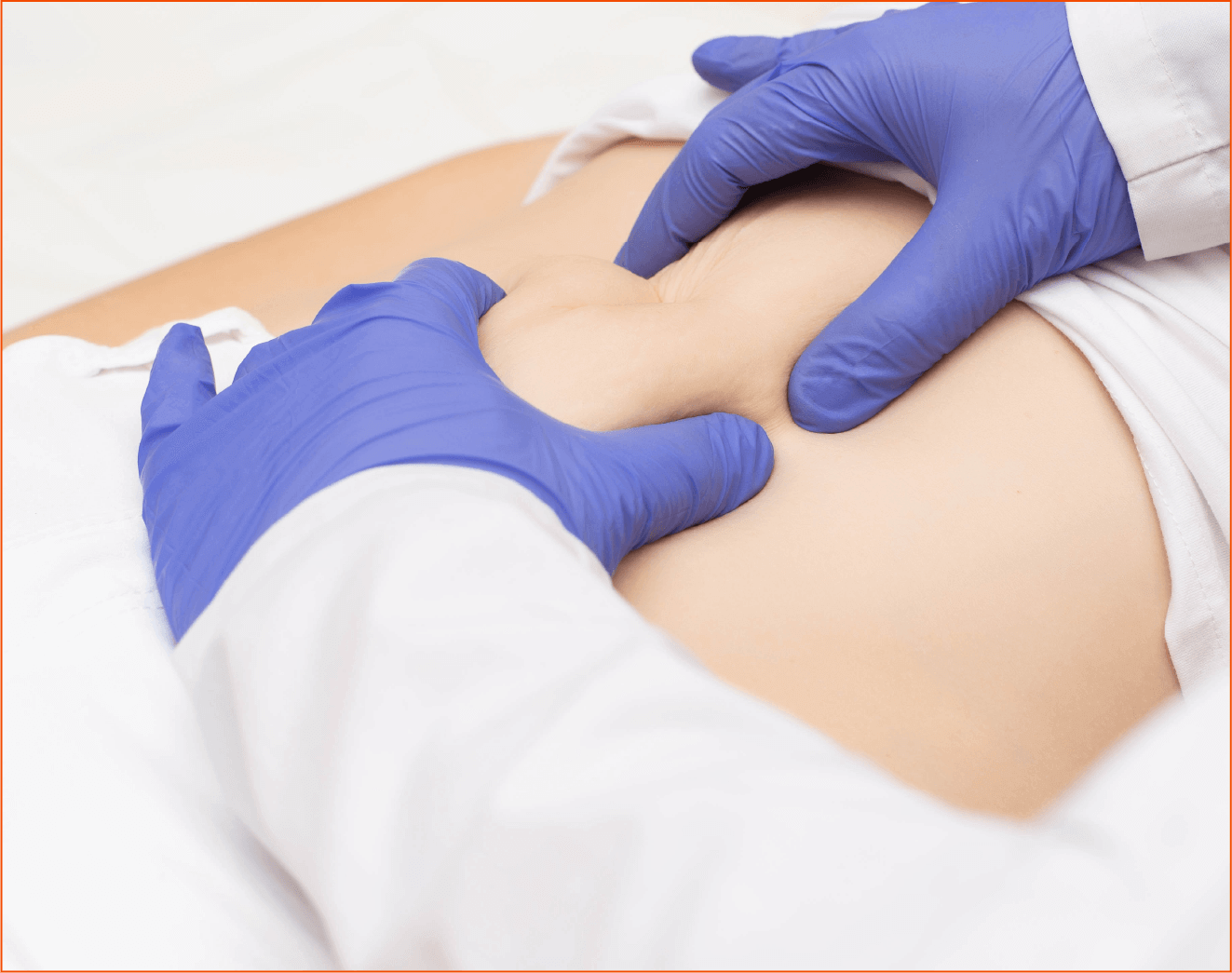 PARASTOMAL HERNIA